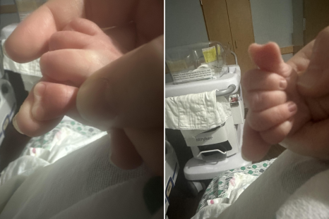 New Mom Discovers Baby Son Was Born With Beautiful Rare 'Heart-Shaped' Thumb