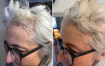 I’ve tried almost every cure for thinning hair — this is what worked