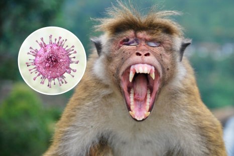 Monkey Bite Gives Man Rare Virus