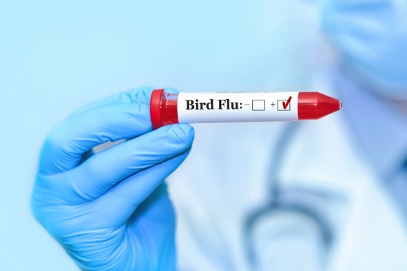 Bird Flu in US: What We Know, What We Don't