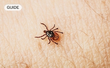 What tick bites look like and how to deal with suspected Lyme disease