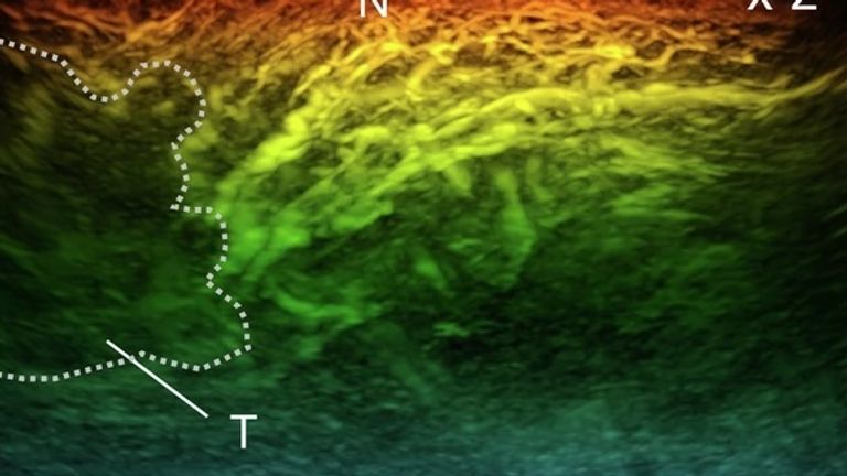 New miniature scanner could revolutionise diagnosis of diseases like cancer, diabetes and arthritis