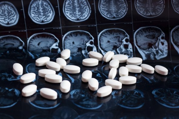 Alzheimer's: Simple Drug Change Could Save Medicare Hundreds of Millions