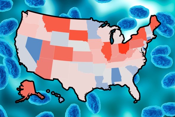 Map Shows US States Where 'Deadly' Whooping Cough Rising