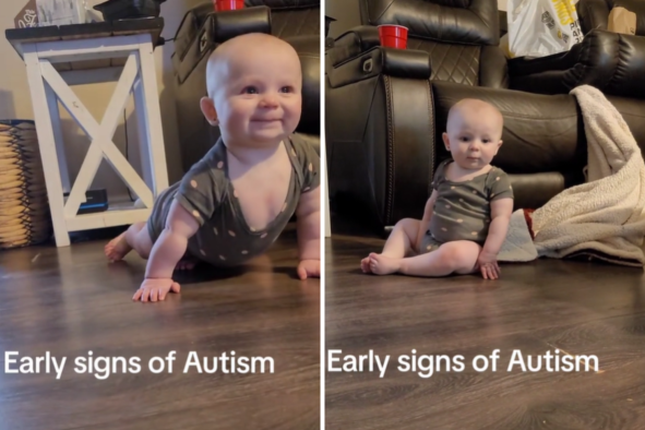 Mom Reveals Early Signs of Autism by Sharing Video of Her 8-Month-Old