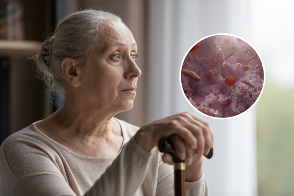 Alzheimer's Link with Gut Health Revealed by New Study